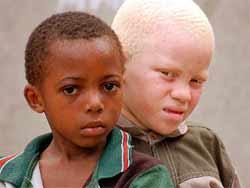 Мутации, Люди-альбиносы